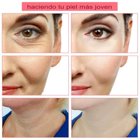 Masajeador Facial Reductor de Papada