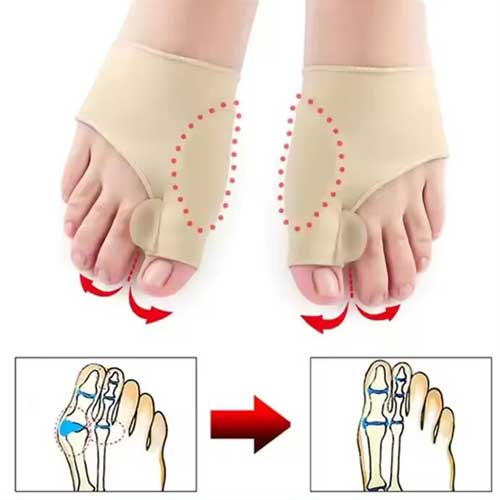 Corrector de Juanete Ortópedico